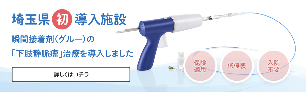瞬間接着剤の下肢静脈瘤治療を導入いたしました