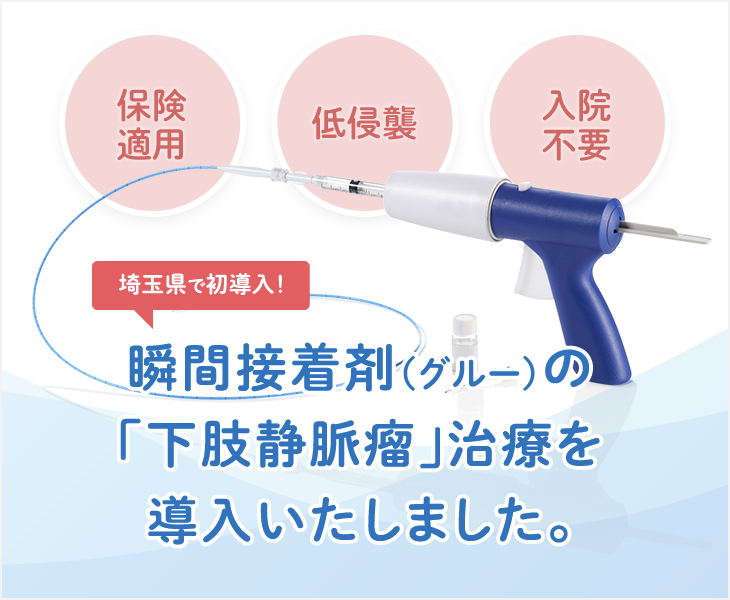 瞬間接着剤の下肢静脈瘤治療を導入いたしました